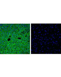 Cell Signaling Fabp1 (D2a3x) Xp Rabbit mAb