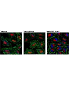 Cell Signaling Lc3a/B (D3u4c) Xp Rabbit mAb (Alexa Fluor 647 Conjugate)
