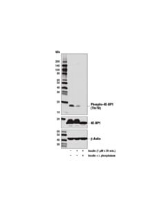 Cell Signaling Phospho-4E-BP1 (Thr70) (D7F6I) Rabbit mAb 20 uL