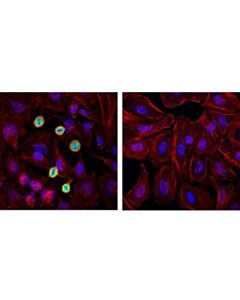 Cell Signaling Phospho-Lamin A/C (Ser22) (D2b2e) Xp Rabbit mAb