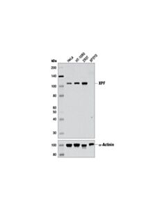 Cell Signaling Xpf (D3g8c) Rabbit mAb