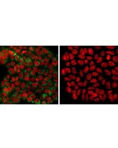 Cell Signaling Sec31a (D1g7i) Rabbit mAb