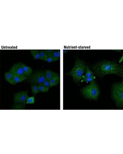 Cell Signaling Atg13 (E1y9v) Rabbit mAb