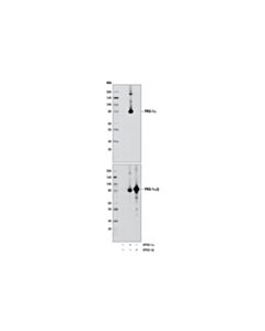Cell Signaling Pkg-1alpha (D10g2) Rabbit mAb