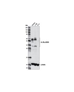 Cell Signaling Il-2ralpha/Cd25 (D6k5f) Rabbit mAb