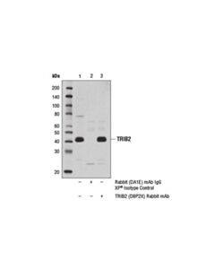 Cell Signaling Trib2 (D8p2x) Rabbit mAb