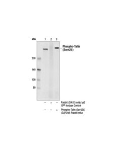 Cell Signaling Phospho-Talin (Ser425) (D2p2m) Rabbit mAb
