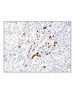 Cell Signaling Mmp-9 (D6o3h) Xp<Lt/>Sup&Gt;®<Lt/>/Sup&Gt; Rabbit mAb