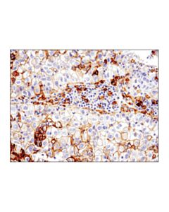 Cell Signaling Pd-L1 (E1l3n ) Xp Rabbit mAb