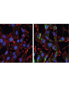 Cell Signaling Gabarap (E1j4e) Rabbit mAb