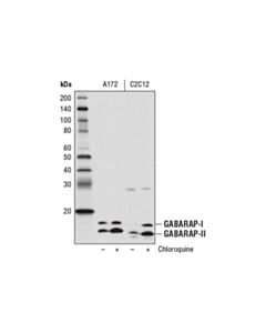 Cell Signaling GABARAP (E1J4E) Rabbit mAb 20 uL