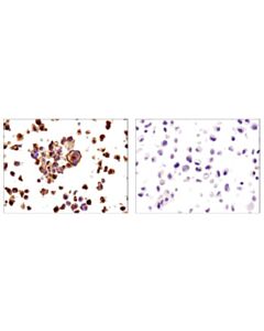 Cell Signaling Signalslide  Pd-L1 Ihc Controls