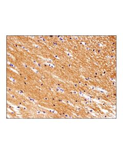 Cell Signaling Thy1/Cd90 (D3v8a) Rabbit mAb