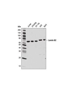 Cell Signaling Lamin B2 (E1s1q) Rabbit mAb