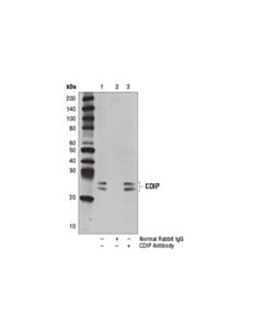 Cell Signaling Cdip Antibody