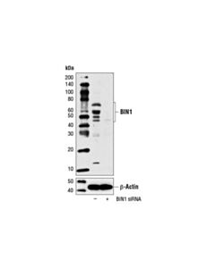 Cell Signaling Signalsilence Bin1 Sirna I