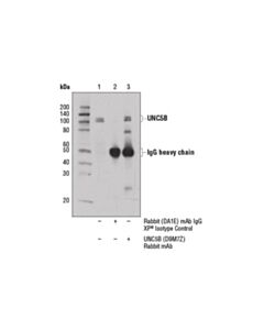 Cell Signaling Unc5b (D9m7z) Rabbit mAb