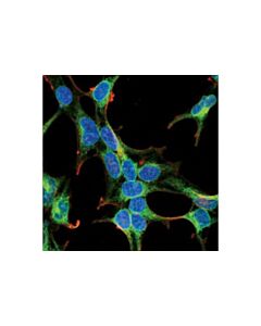Cell Signaling Pgrmc1 (D6m5m) Xp Rabbit mAb