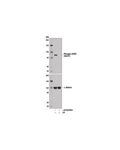 Cell Signaling Phospho-Ssh3 (Ser37) Antibody