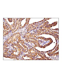 Cell Signaling Pld2 (E1y9l) Rabbit mAb (Ihc Specific)