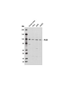 Cell Signaling Pld2 (E1y9g) Rabbit mAb