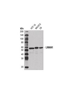 Cell Signaling Lman1 (E2b6h) Rabbit mAb