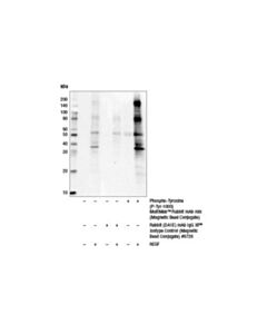 Cell Signaling Phospho-Tyrosine (P-Tyr-1000) Multimab Rabbit mAb Mix (Magnetic Bead Conjugate)