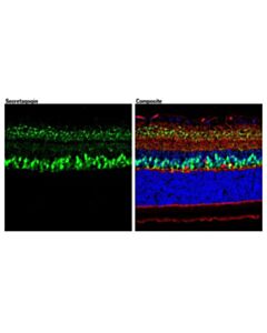 Cell Signaling Secretagogin (D4v1y) Xp Rabbit mAb