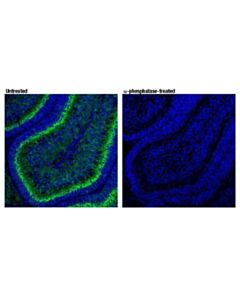 Cell Signaling Phospho-Doublecortin (Ser334) (D11b10) Rabbit mAb