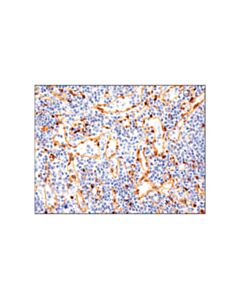 Cell Signaling Yap (D8h1x) Xp<Lt/>Sup&Gt;®<Lt/>/Sup&Gt; Rabbit mAb