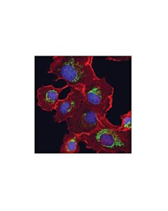 Cell Signaling Phb2 (E1z5a) Rabbit mAb