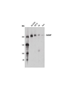Cell Signaling Cdgap (D6j9g) Rabbit mAb