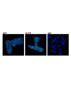 Cell Signaling Spinophilin (E1e7r) Rabbit mAb