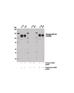 Cell Signaling Phospho-Gef-H1 (Ser886) (E1l6d) Rabbit mAb