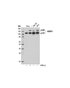 Cell Signaling Adar1 (D7e2m) Rabbit mAb