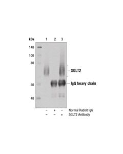 Cell Signaling Sglt2 Antibody
