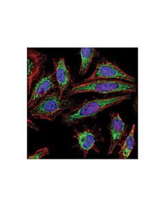 Cell Signaling Citrate Synthase (D7v8b) Rabbit mAb
