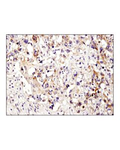 Cell Signaling Xiap (D2z8w) Rabbit mAb