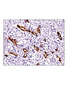 Cell Signaling Cd36 (D8l9t) Rabbit mAb