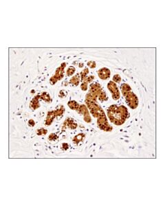 Cell Signaling Comt (D4n6m) Rabbit mAb