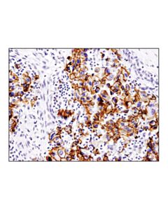 Cell Signaling E-Cadherin (4a2) Mouse mAb