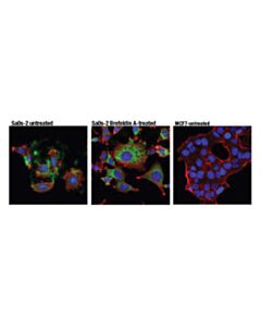 Cell Signaling Cyr61 (D4h5d) Xp Rabbit mAb