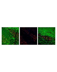 Cell Signaling Phosphoplus Tau (Thr181) Antibody Duet