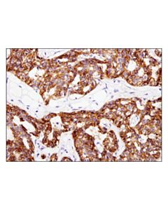 Cell Signaling Igf-I Receptor Beta (D4o6w) Rabbit mAb (Ihc Preferred)