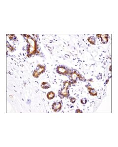 Cell Signaling Inpp4b (D9k1b) Xp Rabbit mAb