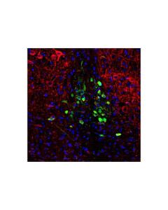 Cell Signaling Cart (D6l8j) Rabbit mAb