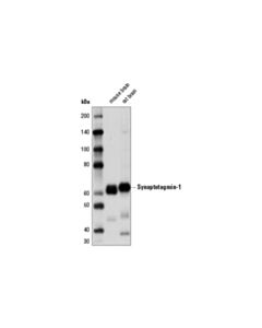 Cell Signaling Synaptotagmin-1 (D33B7) Rabbit mAb 20 uL