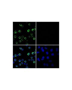 Cell Signaling Myeloperoxidase (E1e7i) Xp<Lt/>Sup&Gt;®<Lt/>/Sup&Gt; Rabbit mAb