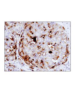Cell Signaling B7-H4 (D1m8i) Xp Rabbit mAb