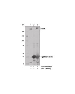 Cell Signaling Nav1.7 Antibody
